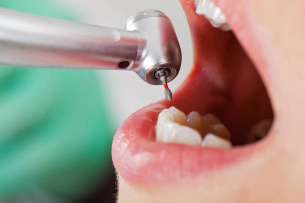 Best Emergency Dental Care for Broken or Chipped Teeth in Bouse, AZ
